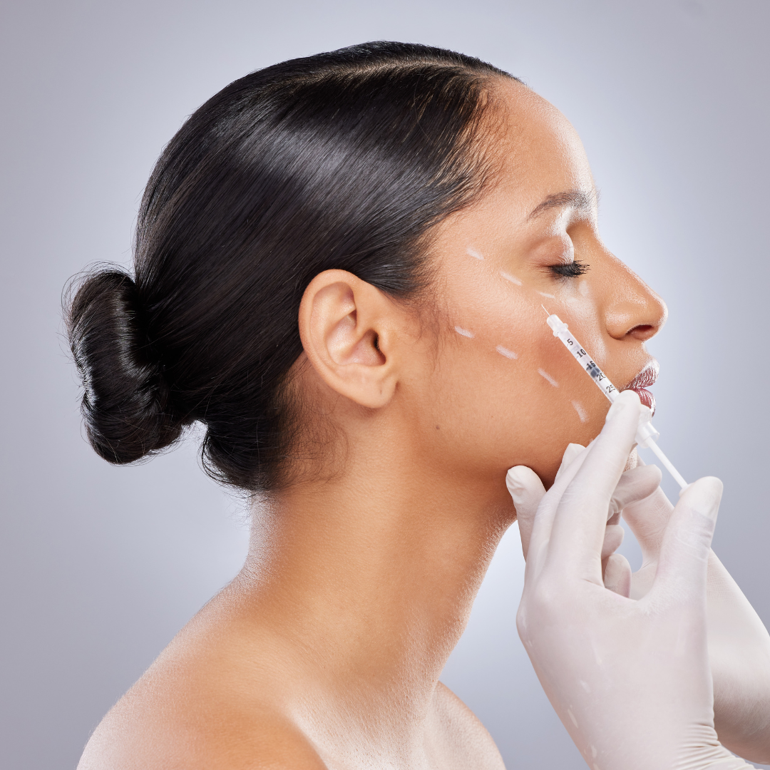 Cheek Filler