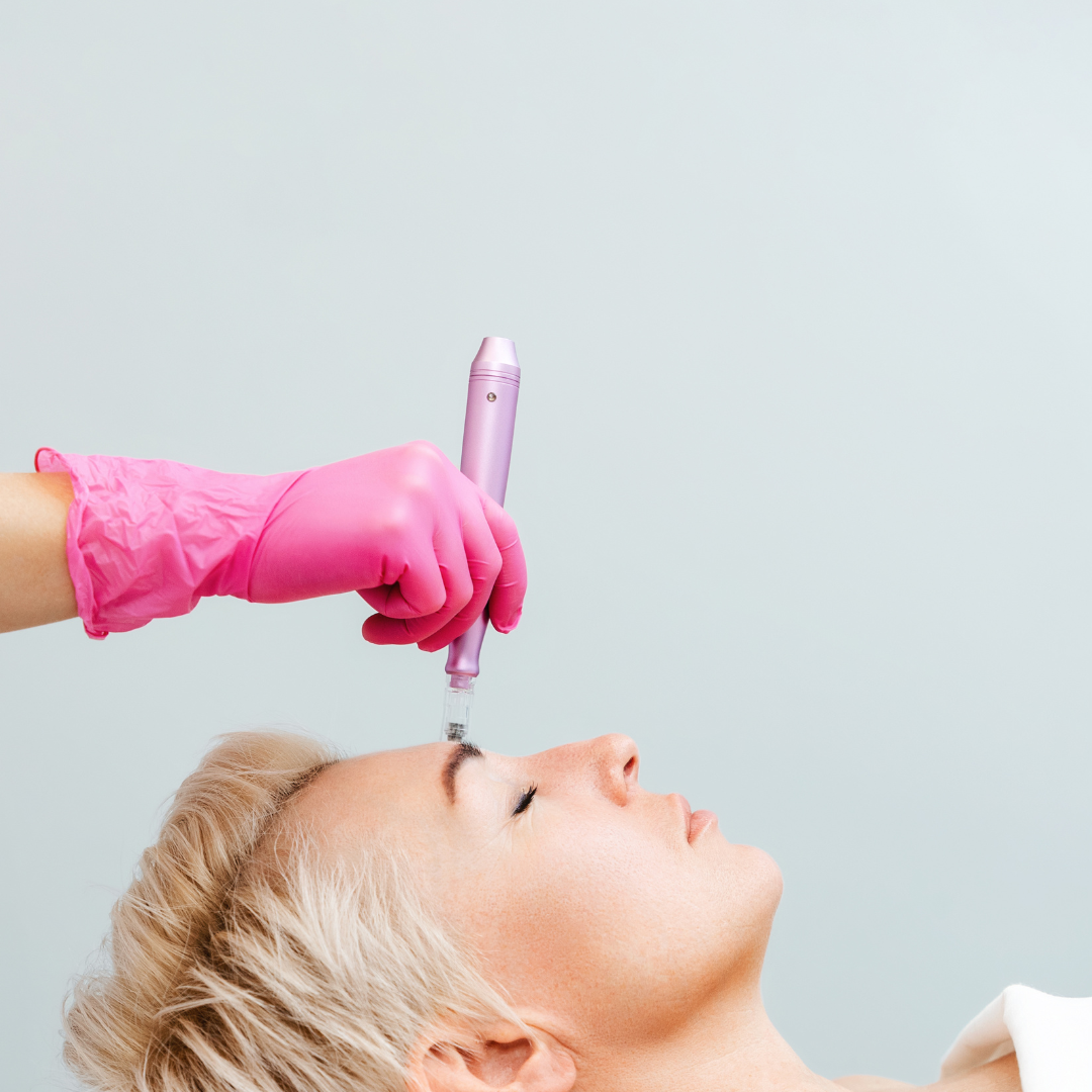 Microneedling