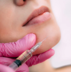 Chin Filler