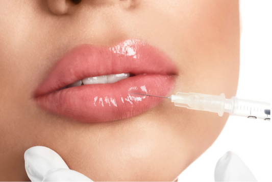 Lip Filler